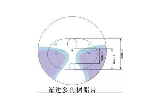 美麗島多焦鏡適合的人群，需要注意的事項